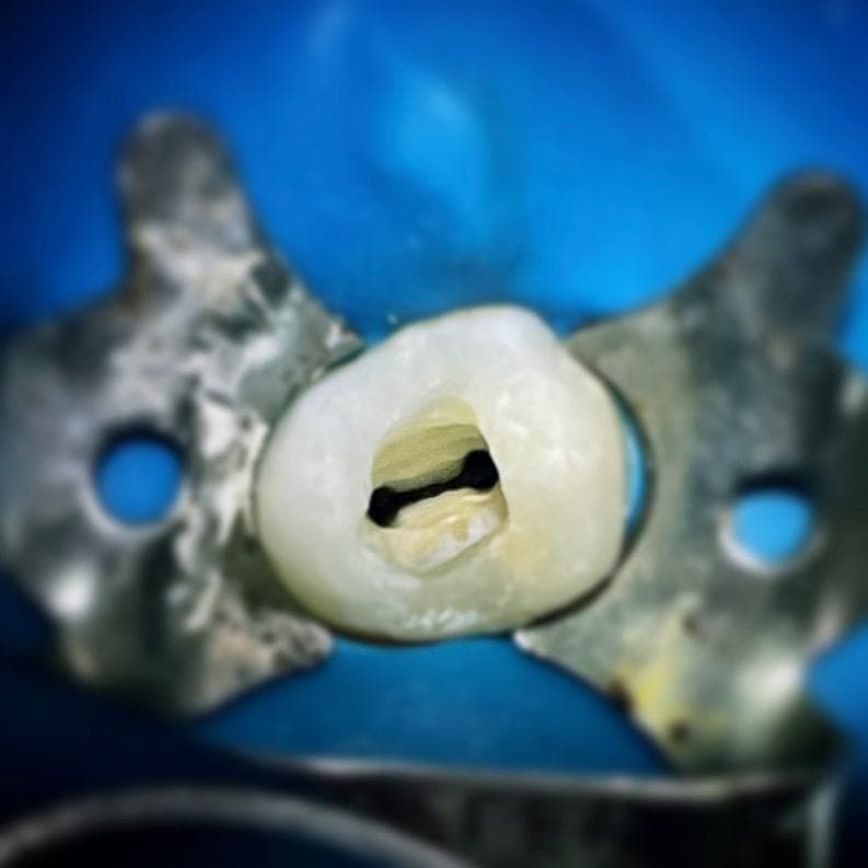 Endodontia